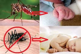 Cách đơn giản giúp trẻ không bị muỗi đốt